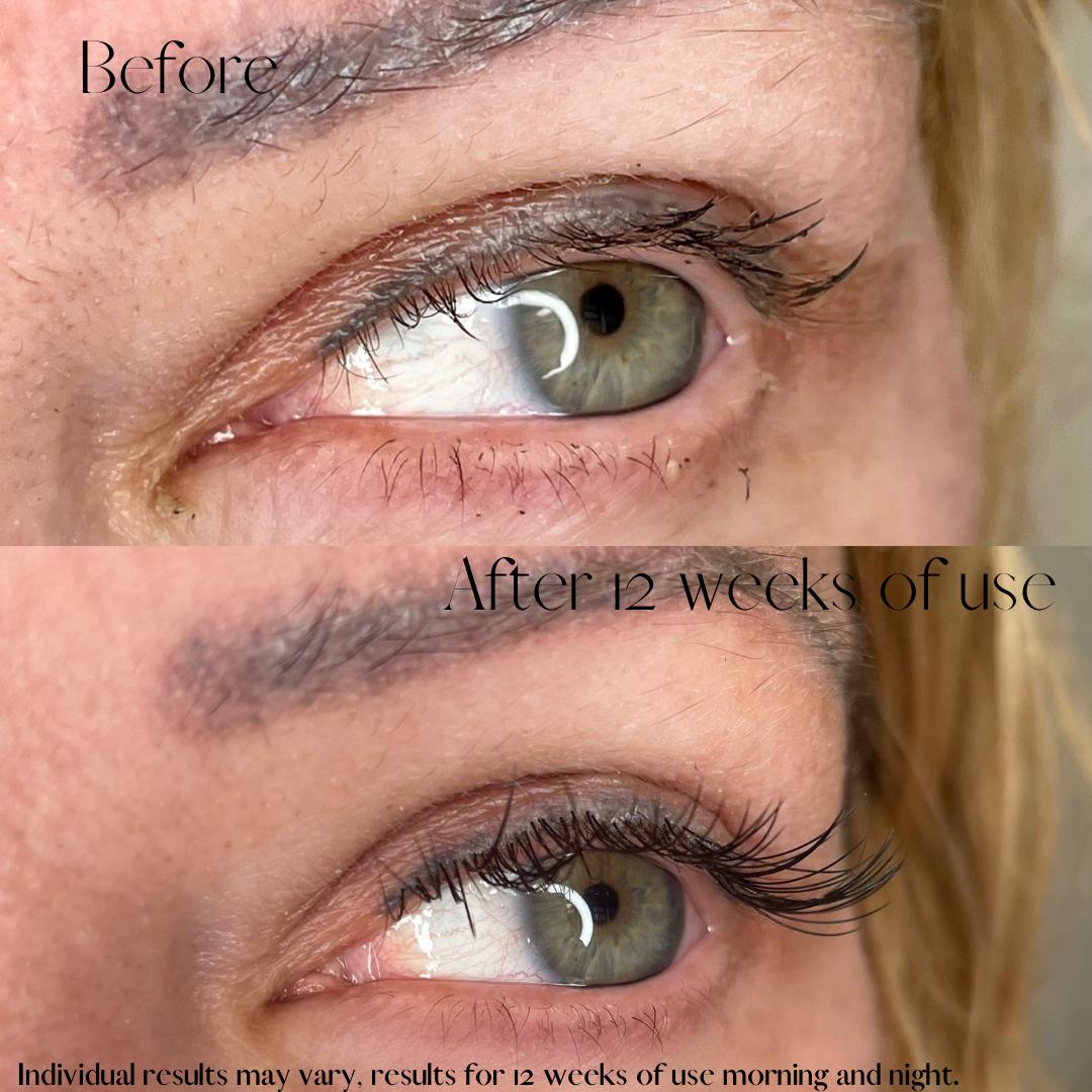 Lash Grow Advanced Conditioning Serum 2ml | Achieve Longer, Fuller, and Voluminous Eyelashes – view 7